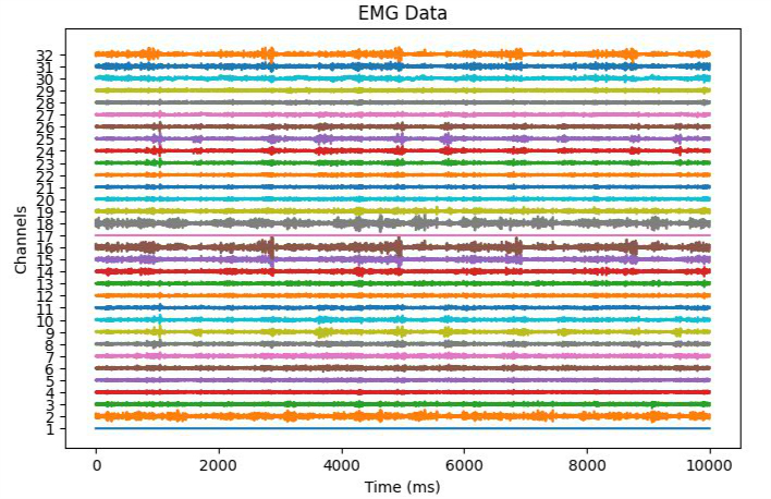 EMG
